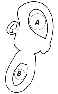 Alternative view of 862375